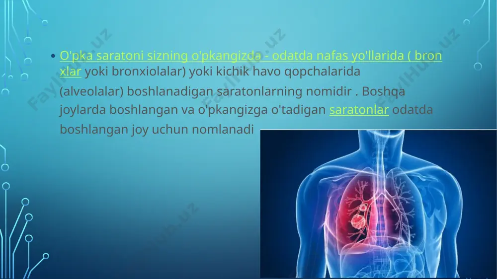 giz. o'pka saratonining oilaviy tarixi. ota-onasi, aka-uka yoki bolasi o'pka saratoni bilan kasallangan odamlarda kasallik xavfi ortadi. o'pka saratoni turlari shifokorlar o'pka saratonini mikroskop ostida o'pka saratoni hujayralarining ko'rinishiga qarab ikkita asosiy turga ajratadilar. sizning shifokoringiz o'pka saratonining qaysi asosiy turiga ega ekanligingizga qarab davolanish to'g'risida qaror qabul qiladi. o'pka saratonining ikkita umumiy turiga quyidagilar kiradi: kichik hujayrali o'pka saratoni. kichik hujayrali o'pka saratoni deyarli faqat og'ir chekuvchilarda uchraydi va kichik hujayrali o'pka saratoniga qaraganda kamroq uchraydi. kichik hujayrali bo'lmagan o'pka saratoni. kichik hujayrali bo'lmagan o'pka saratoni o'pka saratonining bir nechta turlari uchun umumiy atamadir. kichik hujayrali bo'lmagan o'pka saratoniga skuamoz hujayrali karsinoma, adenokarsinoma va katta hujayrali karsinoma kiradi. o'pka saratoni asoratlarni keltirib chiqarishi mumkin, masalan: nafas qisilishi. o'pka saratoni bilan og'rigan odamlarda, agar saraton katta nafas yo'llarini to'sib qo'ysa, nafas qisilishi mumkin. o'pka saratoni, shuningdek, o'pka atrofida suyuqlik to'planishiga olib kelishi mumkin, bu esa nafas olayotganda ta'sirlangan o'pkaning to'liq …