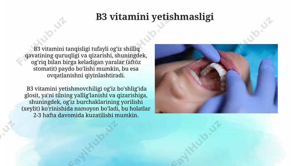bolalarda gipo va avitaminozda og'iz bo'shligidagi o'zgarishlar - Page 5