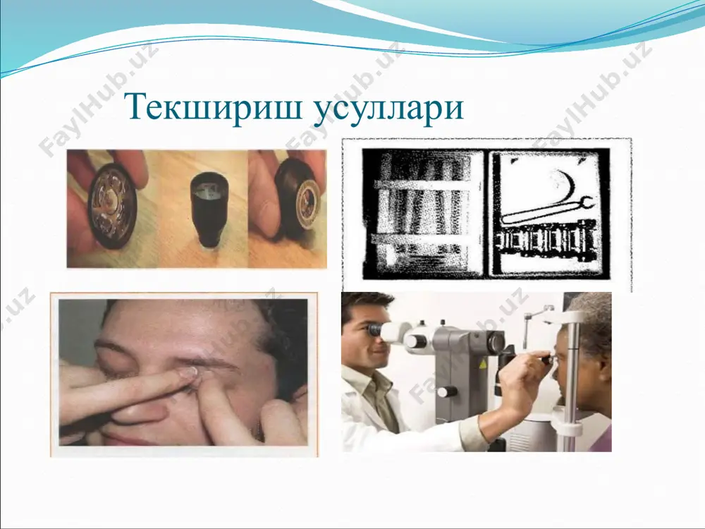 глаукома 2 - Page 3