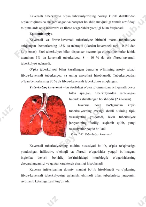 ogiya, yuqumli kasalliklar, endokrinologiya, gematologiya, urologiya, teri-tanotuberkulez kasalliklari, oftalmologiya kabi fanlar bilan bir qatorda tuberkulez kasalligini boshqa kasalliklar bilan qiyosiy tashxislashga asoslanadi. 4. darsning mazmuni 4.1. nazariy qism. kavernali tuberkulyoz o‘pka tuberkulyozining boshqa klinik shakllaridan o‘pka to‘qimasida chegaralangan va barqaror bo‘shliq mavjudligi xamda atrofidagi to‘qimalarda aniq infiltrativ va fibroz o‘zgarishlar yo‘qligi bilan farqlanadi. epidemiologiya. kavernali va fibroz-kavernali tuberkulyoz birinchi marta tuberkulyoz aniqlangan bemorlarning 1,5% da uchraydi (ulardan kavernozli turi – 0,4% dan ko‘p emas). faol tuberkulyoz bilan dispanser kuzatuviga olingan bemorlar ichida taxminan 1% da kavernali tuberkulyoz, 8 – 10 % da esa fibroz-kavernali tuberkulyoz uchraydi. o‘pka tuberkulyozi bilan kasallangan bemorlar o‘limining asosiy sababi fibroz-kavernali tuberkulyoz va uning asoratlari hisoblanadi. tuberkulyozdan o‘lgan bemorlarning 80 % da fibroz-kavernali tuberkulyoz aniqlangan. tuberkulyoz kavernasi – bu atrofidagi o‘pka to‘qimasidan uch qavatli devor bilan ajralgan, tuberkulyozdan zararlangan hududda shakllangan bo‘shliqdir (2.45-rasm). kaverna hosil bo‘lganidan keyin tuberkulyozning avvalgi shakli o‘zining tipik xususiyatini yo‘qotadi, lekin tuberkulyoz …