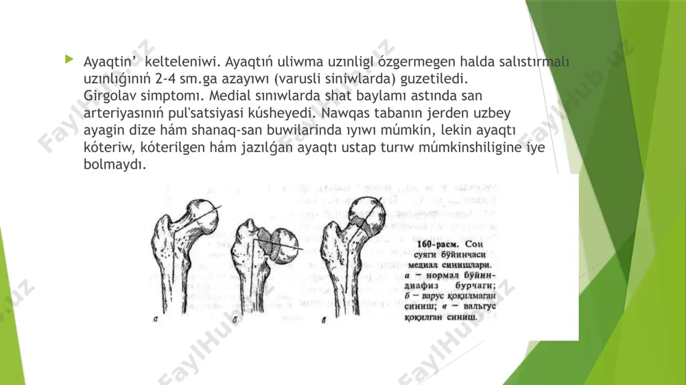 san suyegi jaraqatlari - Page 4