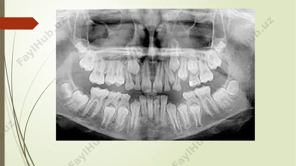 odontoparodontogramma taxlili - Page 4