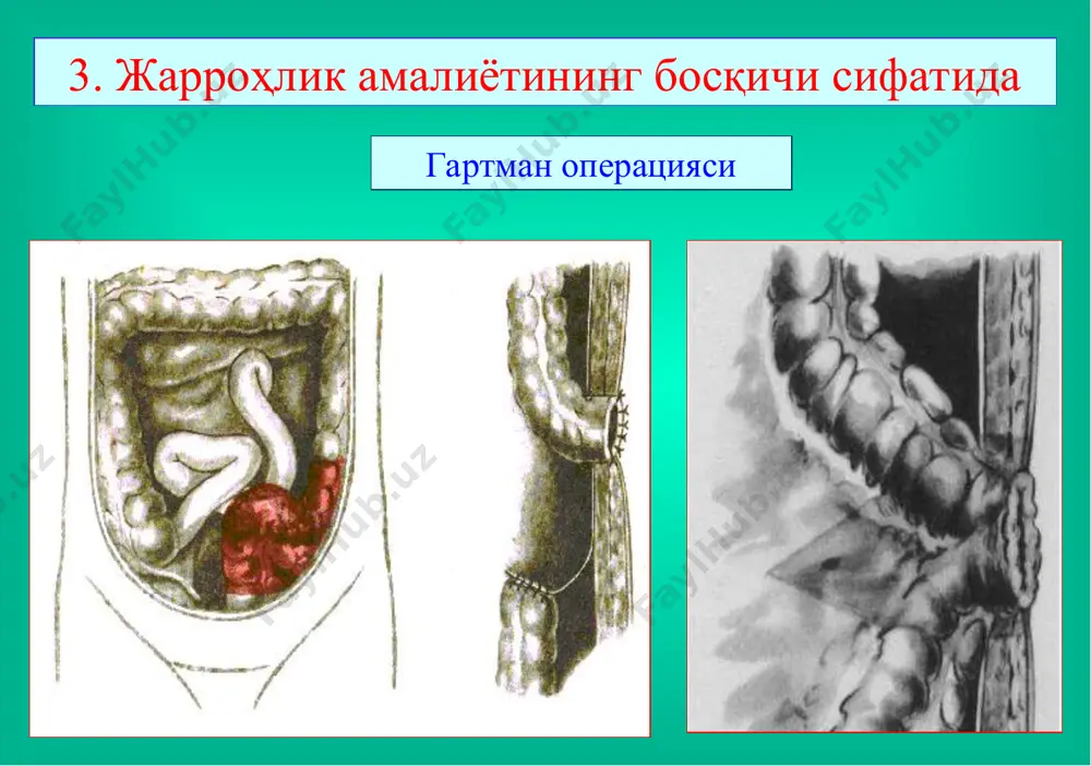 ичак оқмалари - Page 5