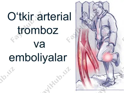 o‘tkir arterial tromboz va emboliyalar — PPT