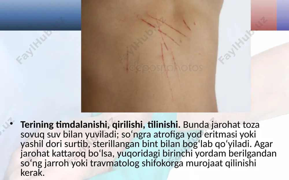kabi noxush holatlar yuz beradi. yosh bolalarda tana harorati ko‘tarilib, hushidan ketadi yoki tirishib qoladi. odam quyosh nuri ta’sirida uzoq vaqt bo‘lsa, oftob urishi mumkin. bunday hodisa sodir bo‘lganida bemor salqin joyga o‘tkaziladi. xonaning derazalarini ochib, havosi yangilanadi; bemorning boshini past, oyoqlarini biroz baland qilib yotqiziladi; sochiqni sovuq suvda ho‘llab, bemorning boshiga qo‘yiladi. sovuq suvda ho‘llangan sochiq yoki doka yelka, bilak, qo‘ltiq, son, tizzaosti sohalariga ham qo‘yiladi. bemorning umumiy holatiga qarab, uning ustidan sovuqroq suv (dush) quyish mumkin; ko‘proq sovuq choy, mineral suv ichiriladi; agar bemorning ahvoli og‘ir bo‘lsa, tez tibbiy yordam chaqiriladi. sovqotganda va sovuq urganda birinchi yordam. odam uzoq vaqt davomida sovuqda bo‘lishi natijasida u sovqotishi yoki uni sovuq urishi mumkin. terini sovuq urganda shu joy yumshoq jun ro‘mol yoki boshqa issiq, yumshoq mato bilan isitiladi. savol va topshiriqlar teri jarohatlanganda qanday birinchi yordam beriladi? tananing turli sohalaridan qon ketganda qanday to‘xtatiladi? teri kuyganda qanday yordam beriladi? issiq …