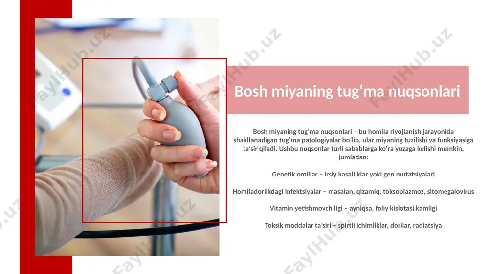 dagi nuqsonlar (dandy-walker sindromi) neyron naycha defektlari irsy kasalliklar ✅ orttirilgan omillar: infektsiyalar (meningit, ensefalit) miya ichki qon ketishi (ko‘pincha chala tug‘ilgan chaqaloqlarda) shikastlanishlar (travmatik bosh miya jarohatlari) o‘smalar yoki kistalar (miya o‘smasi likvor oqimini to‘sib qo‘yishi mumkin) tashxis va davolash 🔬 tashxis: ultratovush tekshiruvi (utt) – yangi tug‘ilgan chaqaloqlarda kt (kompyuter tomografiyasi) yoki mrt (magnit-rezonans tomografiya) 💊 davolash usullari: shunt operatsiyasi – ortiqcha suyuqlikni chiqarib tashlash uchun maxsus naycha o‘rnatish. endoskopik uchinchi ventrikulostomiya (etv) – miya suyuqligi oqimini tiklash uchun jarrohlik muolajasi. dori vositalari – ba’zi hollarda simptomlarni yengillashtirish uchun qo‘llaniladi. dandy-walker sindromi dandy-walker sindromi – bu orqa miya va miyachaning tug‘ma rivojlanish nuqsoni bo‘lib, miya suyuqligi (likvor) oqimi buzilishi natijasida gidrotsefaliya rivojlanishiga olib kelishi mumkin. ushbu sindrom homila rivojlanishining 7-10-haftalarida shakllanadi va miya strukturasi anomaliyalariga sabab bo‘ladi. asosiy xususiyatlari 🧠 miyacha va miya suyuqligi yo‘llarining rivojlanishidagi nuqsonlar: miyachaning rivojlanishida kamchiliklar (harakat muvozanati va muvofiqlashtirish buziladi) to‘rtinchi miya qorinchasi …