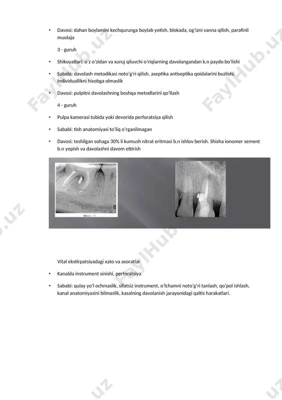 i. ekstirpatsiyadan keyingi qonash · to’liq ekstirpatsiya qilmaslik, pulpani yirtilib olinishi, apical yoriqdan uzilishi va o’sha yerda gematoma paydo bo’lishi · yordam: qon to’xtatuvchi moddalar: peroksid, aminokapron kislota. diatermokoagulyatsiya plombadan keyingi doimiy va tishlaganda kuchayuvchi og’riqlar · sababi: aseptika qoidalari buzlishi, periodontni ta’sirlantiruvchi moddalar ishatish, silerni noto’g’ri tanlash, kanaldan siler chiqishi yoki to’liq yetib bormasligi, instrumental travma. · yordam: fizioterapiya (gidrokortizon b.n), davolovchi damlamalar b.n chayish, kanalni rentgent nazoratida qayta plombalash 5 - guruh · mishyakli pastalarni qo’ygandan k.n paydo bo’luvchi og’riqlar · sababi: mishyakni to’liq ochilmagan pulpa kamerasiga qo’yish yoki qo’ygandan keying qattiq tamponade · yordam: qo’yilganlarni olib tashlab boshqatdan qo’yish, ustidan paxtali tampon qo’yish va germetik yopish. pulpa kamerasini ochilganligini tekshirish. papillit, lokalizatsiyalashgan parodontit · mishyakli pastani milk so’rg’ichi yoki tishlararo oraliqqa tushishi · yordam: o’sha sohani to’liqligicha ko’zdan kechirish, tozalash. 5% li unitiol, yod nastoykasi, yalliglanishga qarshi va regeneratsiyalovchi terapiya o’tkazish · amputatsiyadan keyin kanal og’zi zondlanganda …
