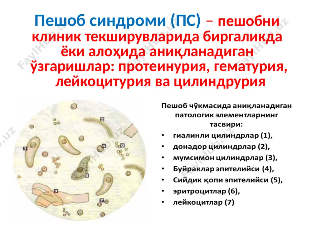 сийдикчўкмасидагиўзгаришлар биланкечадиганкасалликларни қиёсийташҳислаш - Page 4