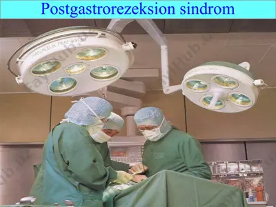 postgastrorezeksion sindrom — PPT