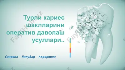 kariyesni davolash — PPTX