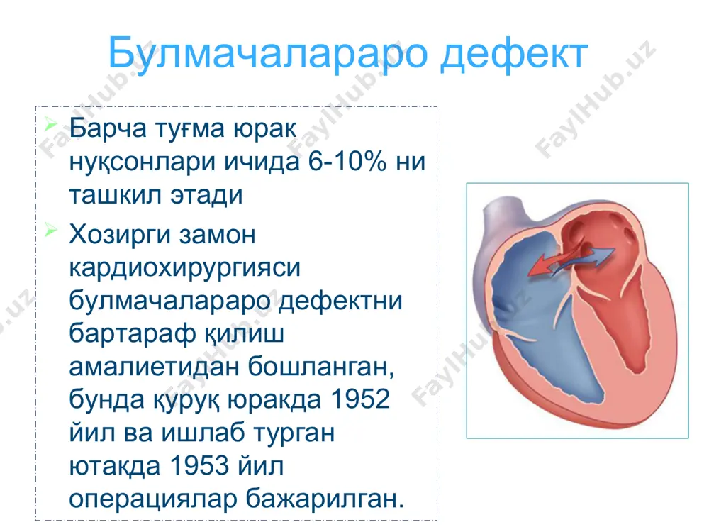 kada kolish ko'krak kafasini deformatsiyasi tush suyagining chap tomonida iii-iv kovurgalar aro soxasida sistolik shovkin nukson soxasiga yamok tikilgan korinchalar aro devorning nuksoni yurak devori nuksonini yopish uchun transkateter sistemali (amplatzer) okklyuder fallo tetradasi o'pka arteriyasini torayishi, korinchalar aro tusik nuksoni, aortani o'ng tomonga siljishi va uni korinchalar aro tusik nuksonini ustida joylashishi o'ng korincha devorining gipertrofiyasi fallo tetradasi fallo tetradasi umrovosti- upka anastomozi (blelok-tausig amaliyoti) fallo tetradasida korinchalar aro tusik nuksoniga yamok tikish aorta koarktatsiyasi bosh ogrishi arterial kon bosimining oshishi burindan kon ketishi yurak soxasidagi ogriklar yurak urishi boshda ogirlikni va pulsatsiyanni sezish aorta koarktatsiyasi