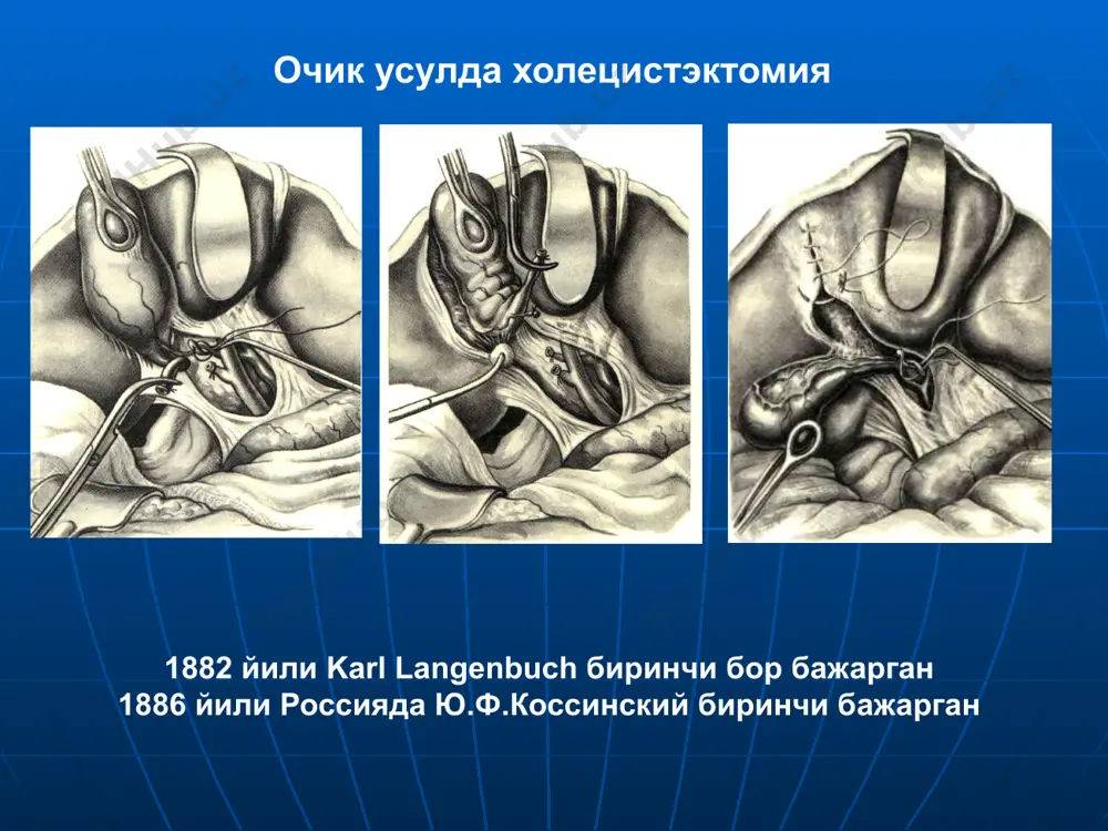 ўт йўлларида бажарилган амалиётлардан кейинги касалликлар - Page 5