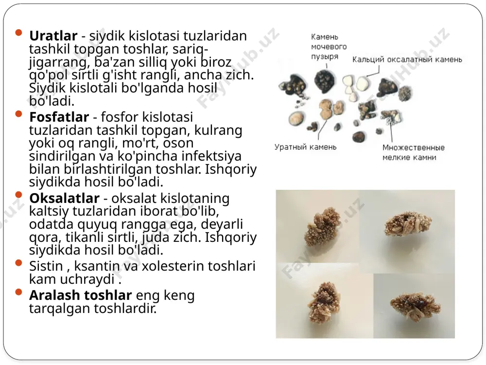 hiligi bilan yuzaga keladi va urat toshlarining shakllanishiga olib kelishi mumkin. . giperfosfaturiya (siydikda fosfor miqdori ortishi) oshqozon yoki markaziy asab tizimining birlamchi kasalliklari natijasida tug'ma yoki orttirilgan fosfat diatezining namoyon bo'lishi mumkin. ko'pincha fosfaturiya noto'g'ri (ph 7,0 va undan yuqori), bu gidroksidi hosil qiluvchi bakteriyalarga (proteus) bog'liq. siydik tosh kasalligini tashxislash uchun radiatsiya usullari: ultratovush diagnostikasi buyraklar, siydik pufagi, siydik pufagining yuqori va pastki uchdan bir qismida joylashgan toshlarni ko'rishga imkon beradi. bunday holda, toshning o'lchamini, uning shakli va joylashishini aniqlash mumkin. ultratovush tekshiruvi paytida siydik yo'llarining toshlari (toshi) tufayli buyrakdan siydik chiqishining buzilishi piyelokaliya tizimining kengayishi bilan namoyon bo'ladi. rentgenologik tadqiqot usullari. rentgen tekshiruvi nuqtai nazaridan konkretsiyalar (toshlar) radio-salbiy (standart oddiy rentgen nurlari bilan ko'rinmaydi) va radiopozitiv (standart oddiy rentgen nurlari bilan tasvirlangan) bo'lishi mumkin. rentgen salbiy toshlar siydik kislotasi tuzlaridan ( urat ) tashkil topgan toshlardir . qolgan toshlar, shu jumladan aralash toshlar, rentgen nurlari ijobiydir . …