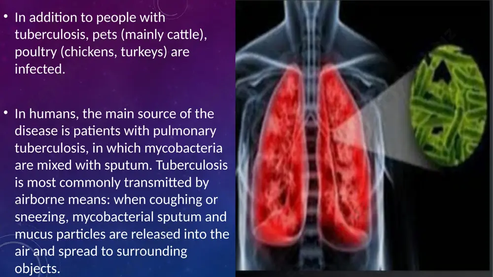 tuberculosis - Page 5