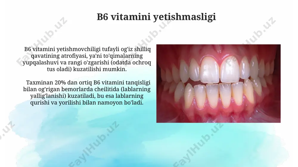 'shti qonashining kuchayishiga olib keladi. d vitamini defitsitini boshdan kechirayotgan bolalarda emal gipoplaziyasi xavfi 2-3 baravar ortadi, bu esa tishlarning mustahkamligini pasaytiradi va karies xavfini oshiradi. vitaminlarning ogʻiz boʻshligʻiga taʼsiri c vitamini tanqisligi skurvi kasalligini keltirib chiqaradi, bu esa ogʻiz boʻshligʻida qon ketishiga, shilliq qavatning shishishiga va 5-10 kungacha davom etadigan ogʻriqli yaralar hosil boʻlishiga olib keladi. riboflavin (b2 vitamini) etishmasligi ogʻiz burchaklarida yorilish (angular stomatit) va ogʻiz shilliq qavatining yorqin qizil rangga boʻyalishi bilan namoyon boʻladi, bu esa og'riq va noqulaylik keltirib chiqaradi. gipovitaminoz va avitaminoz tushunchalari gipovitaminoz organizmda vitaminlarning yetarli darajada bo'lmasligi, lekin avitaminoz darajasiga yetmagan holatni bildiradi, masalan, c vitaminining sutkalik normasidan 25-50% kamligi. gipovitaminoz va avitaminozning og'irlik darajasi qabul qilingan vitamin miqdoriga, vitaminning turini va bemorning individual xususiyatlariga bog'liq bo'lib, 4 bosqichda baholanadi. folat kislotasi yetishmasligi folat kislotasi yetishmovchiligi bilan og'rigan bemorlarda og'iz bo'shlig'ining shikastlanishi, masalan, stomatit yoki gingivit, ko'pincha boshqa b vitaminlari yetishmasligi bilan birgalikda …