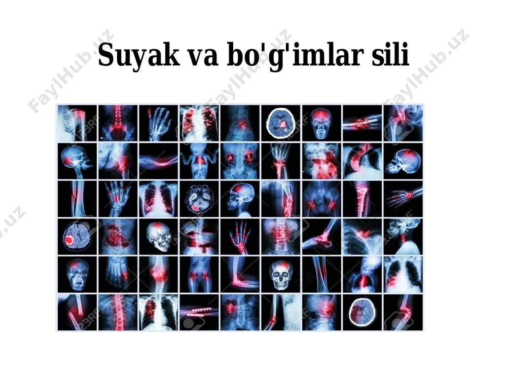 periferik limfa tugunlari sili - Page 5