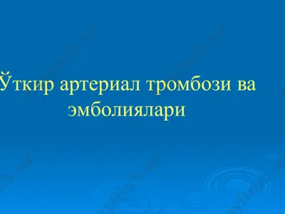 ўткир артериал тромбози ва эмболиялари — PPTX
