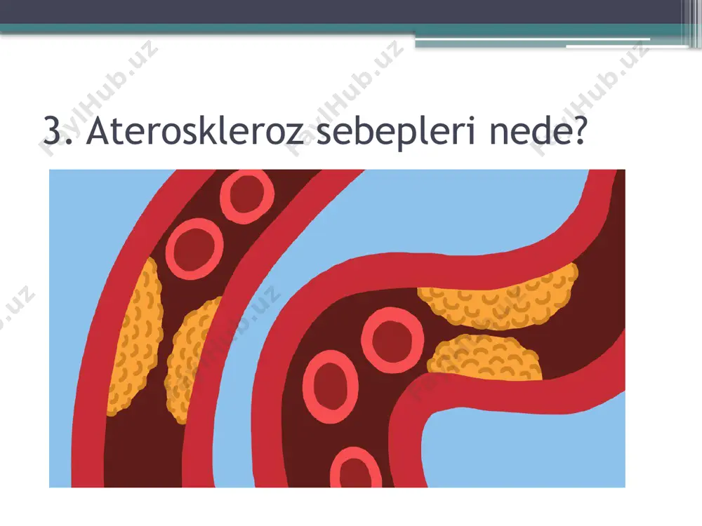 ekke bariwshi arteriyalar taraysa, qan ag’imi a’stelesip ketedi. bul ju’rektin’ ishemiyaliq keselligi ha’m stenokardiyasina alip keledi. sonin’ menen birge miokard infarkti ha’m o‘lim menen de tamamlaniwi mu’mkin. miyge qan jetkizip beriwshi qan tamirlarinin’ tarayiwi insultqa sebep boladi. qol yaki ayaq arteriyalarindag’i ateroskleroz tamir tartisiwina, muskullar awiriwi ha’m ayirim jag’daylarda gangrenag’a alip keledi. qashan shipakerge mu’ra’jet etiw kerek? joqaridag’i belgiler payda boliwi menen shipakerge mu’ra’jet etiw kerek. birinshi uliwma a’meliyat shipakeri ko’riginen o’tiledi. tekseriwlerge qaray, kesellikke qaysi arteriyalar sebep bolg’anina qarap qa’niyge shipakerge jiberedi. ju’rek qan tamirlari aterosklerozin kardiolog ha’m kardioxirurg, bas miy tarawi nevropatolog, qol-ayaqlarda angiolog yaki qan tamir xirurg shipakeri, bu’yrekti nefrolog ko‘zden o’tkeredi. ateroskleroz qalay emlenedi. turmis ta’rizin o’zgertiw arqali ( racional awqatlaniw, fizikaliq miynet penen shug’illaniw) dene massasi indeksi (imt) 18,5 ten 24,9 g’a shekem bolip optimal salmaqti saqlaw. aterosklerozdi emlew ushin aterogen lipoproteinlerdin’ payda boliwina tosqinliq etiwshi, ishekte xolesterin soriliwin toqtatiwshi, lipid metabolizmin fiziologik jaqtan jaqsilawshi, …