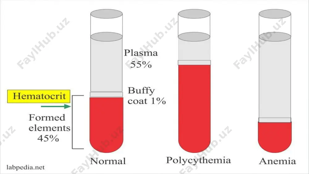 eritrositlar patologiyasi - Page 5