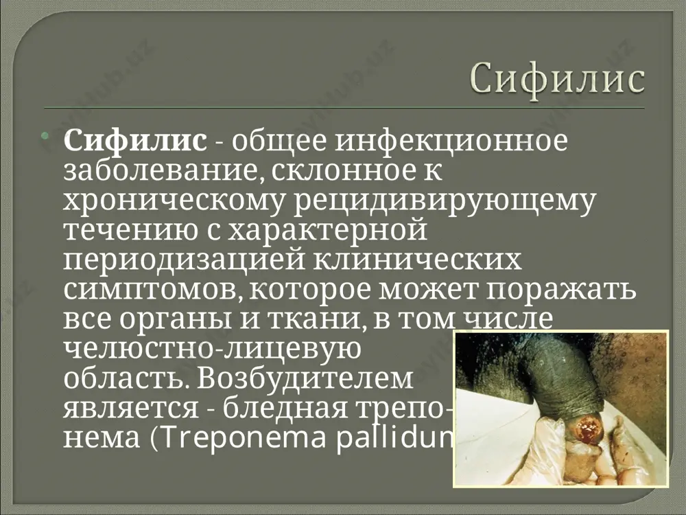 5-18 дней. первичный период сифилиса syphilis primaria -начальная стадия болезни - манифестирует образованием на месте внедрения бледной трепонемы - первичного аффекта (первичной сифиломы, или твердого шанкра), обусловленного скоплением бледных трепонем. принятое деление на первичный серонегативный период (первые 2-3 нед), когда рв отрицательная, и первичный серопозитивный период (вторые 3-4 нед), когда рв становится положительной, хотя и является условным, тем не менее имеет большое практическое значение, т. к. позволяет дифференцировать активность течения про­цесса, характер терапии и высказать предположения о прогнозе заболевания. вторым клиническим симптомом первичного сифилиса является поражение лимфатических узлов, сопутствующий склерааденит. при локализации шанка на половых органах увеличиваются паховые лимфоузлы, на верхних конечностях – локтевые и подмышечные, на молочных железах - подмышечные, на нижней губе – подчелюстные. узлы не спаяны ни между собой, ни с окружающей клетчаткой, ни с кожей. безболезнены. гигантский твердый шанкр нижней губы интрамаммарный твердый шанкр вторичный период сифилиса вторичный период сифилиса при классическом течении инфек­ции манифестирует спустя …