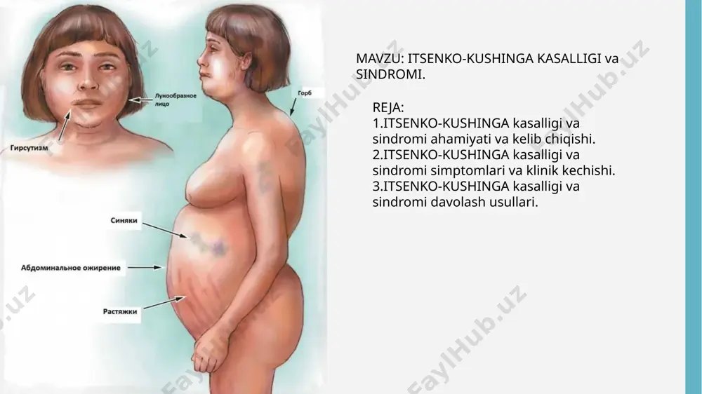 di. organizmdagi kortizol miqdorini aniqlashni 3 xil usuli bor. 1.kechqurun so’lakdagi kortizolni miqdorini aniqlash .chunki odatda tunda kortizol miqdori past bo’ladi .lekin bu kasallikda kortizol sirkulyatsiyasi buziladi, 2ng\ml dan baland bo’lganda. 2.siydakdagi kunlik kortizol miqdorini anaiqlash . 3.kechqurun kam miqdorda 1 mg deksometazon yuboriladi, soat 11.00 da keyin soat 8.00 dan 9.00 gacha o’lchanadi agar 1,8 mkg/dl dan ko’p bo’lsa . tekshirilgandan keyin u kortizol miqdoriga qarab u aktg ga bog’liq yokida yo’qligini aniqlasak bo’ladi. agar 20 pg/ml dan ko’p bo’lsa aktg ga bog’liq agar 5pg.ml dan kam bo’lsa aktg ga bog’liq emas . bunda gipofizda adenoma buyrak usti bezida o’sma mrt diagnostikasida aniqlimiz. kt qorin bo’shlig’ini qilib tekshiriladi agar karsinoma bo’lsa bu10 dan 50 yosh oralig’idagi bemorlarda uchraydi . 1.ayollarda ortiqcha androgen ishlab chiqarilishi 2.akne 3.girsutizm {soqol}. tashxis qo‘yilgandan so‘ng davolash muolajalarini tez boshlash lozimdir. hozirda davolashning 3 ta yo‘nalishi mavjuddir: jarrohlik usuli; medikamentoz usuli; nur bilan davolash usul …