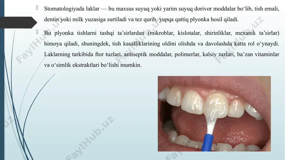 an himoya qilish, emal va dentinni mustahkamlash, sezgirlikni kamaytirish va antiseptik ta’sir ko‘rsatishda katta ahamiyatga ega. ular profilaktika va davolash jarayonining ajralmas qismi bo‘lib, ayniqsa bolalarda kariesning oldini olishda samarali vosita hisoblanadi. xulosa xulosa qilib aytganda, stomatologiyada ishlatiluvchi laklar og‘iz bo‘shlig‘i gigiyenasi va tish salomatligini saqlashda katta ahamiyatga ega. ular tish yuzasida himoya qavati hosil qilib, kariesning oldini oladi, emalni mustahkamlaydi, sezgirlikni kamaytiradi hamda davolash jarayonida yordamchi vosita sifatida xizmat qiladi. ftoridli, antibakterial, desensibilizatsiya qiluvchi va himoya laklari turli klinik vaziyatlarda qo‘llanilib, profilaktika va davolash samaradorligini oshiradi. demak, laklardan oqilona va ilmiy asoslangan tarzda foydalanish stomatologik amaliyotda nafaqat tishlarni sog‘lom saqlash, balki og‘iz bo‘shlig‘i kasalliklarini kamaytirishda ham muhim o‘rin tutadi. foydalanilgan adabiyotlar juldoshev r.x., xodjieva d. «stomatologiya asoslari». – toshkent: fan, 2018. karimova d., abdullayev sh. «tish kasalliklarini davolashda profilaktik usullar». – toshkent: ibn sino, 2019. abdullaev a.a. «bolalar stomatologiyasi». – toshkent: tibbiyot nashriyoti, 2020. juraev m.m. «terapevtik stomatologiya». – …