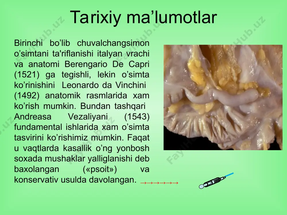 arilgan, lekin bunda o’simta o’zgarmagan edi. epidemiologiya o‘tkir appenditsit – xirurgik kasalliklar ichida keng tarqalgan xastalik bo‘lib, har 200-300 odamga 1 bemor uchraydi. mdxda yil mobaynida o‘tkir appenditsit tufayli 1 mln dan ortiq operatsiyalar qilinadi. yurtimizda 1 yil mobaynida 500 mingdan dan ortiq bemor bu kasallik bo‘yicha shifoxonalarga yotqizilgan va ulardan 89% bemor appendektomiya operatsiyasini boshidan o‘tkazadi. . amaliyotdan keyingi o’lim darajasi - 0,2-0,3%, uzbekistonda - 0.2% o‘tkir appenditsit - chuvalchangsimon o‘simtaning o‘tkir nospetsefik yallig‘lanishi. . chuvalchangsimon o‘simta (appendix) ning qorin oldi devoriga proeksiyasi normal medial retrotsekal chuvalchangsimon o‘simtaning ko‘r ichak (coecum) ga nisbatan joylashish variantlari kichik chanoq sohasida jigar osti sohasida chuvalchangsimon o‘simtaning qorin bo‘shlig‘ida joylashish variantlari qon bilan ta’minlanishi arterial qon bilan ta'minlanishi aorta – a.mesenterica superior – a.ileocolica – a.appendicularis venoz sistema v.appendicularis – v.ileocolica – v. .mesenterica superior – v.portae o‘tkir xirurgik kasalliklar o‘rtasida o‘tkir appenditsitning tarqalish ko‘rsatkichi o‘tkir appenditsit o‘tkir xoletsistit oshqozon va 12 b.i. …