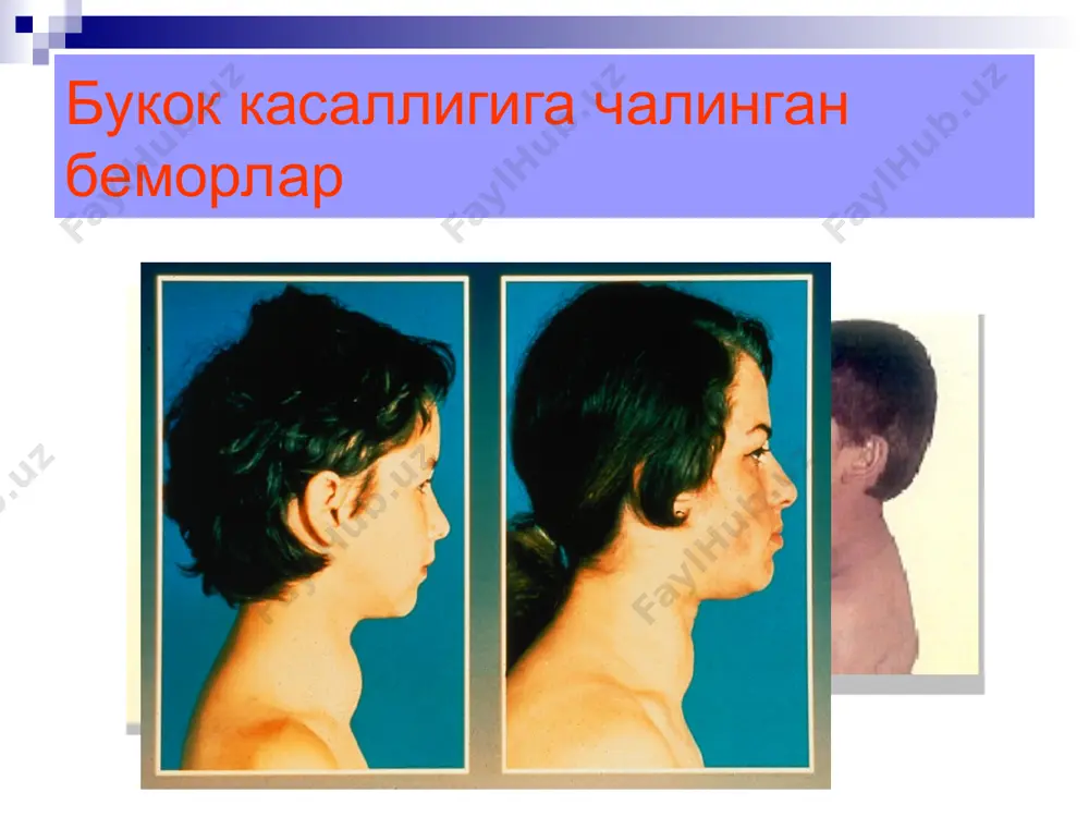 оятида калконсимон без касалликлари билан касалланиш (100000 ахолига) диаграмма8 2822.4 3713.1 2822,4 3713,4 2003 2004 наманган вилоятида эндокрин хасталиклар билан касалланиш (100000 ахолига) диаграмма9 306.2 325 325 306,2 2003 2004 наманган вилоятида кандли диабет билан касалланиш (100000 ахолига) диаграмма10 34.5 39.5 31.6 33.5 34,5 39,5 31,6 33,5 жами шундан болалар 2003 2004 наманган вэдда уринлар айланиши диаграмма11 36.6 50.1 36,6 50,1 2003 2004 наманган вилоятида диффуз токсик букок билан касалланиш (100000 ахолига) диаграмма12 10.7 12 10,7 12 2003 2004 наманган вилоятида гипотиреоз хасталиги билан касалланиш (100000 ахолига) диаграмма13 2288.9158379821 3031.3849138977 2003 2004 наманган вилоятида эндемик букок касаллиги билан касалланиш диаграмма14 2002 2002 2002 2003 2003 2003 2004 2004 2004 комалар гипогликемик гипергликемик наманган вилоятида диабетик комалар 35 23 12 36 19 17 37 15 22 диаграмма15 2002 2002 2003 2003 2004 2004 ампутациялар диабетик курлик кандли диабетнинг сурункали асоратлари 19 28 25 38 36 51 диаграмма16 2002 2003 2004 нефропатиялар …