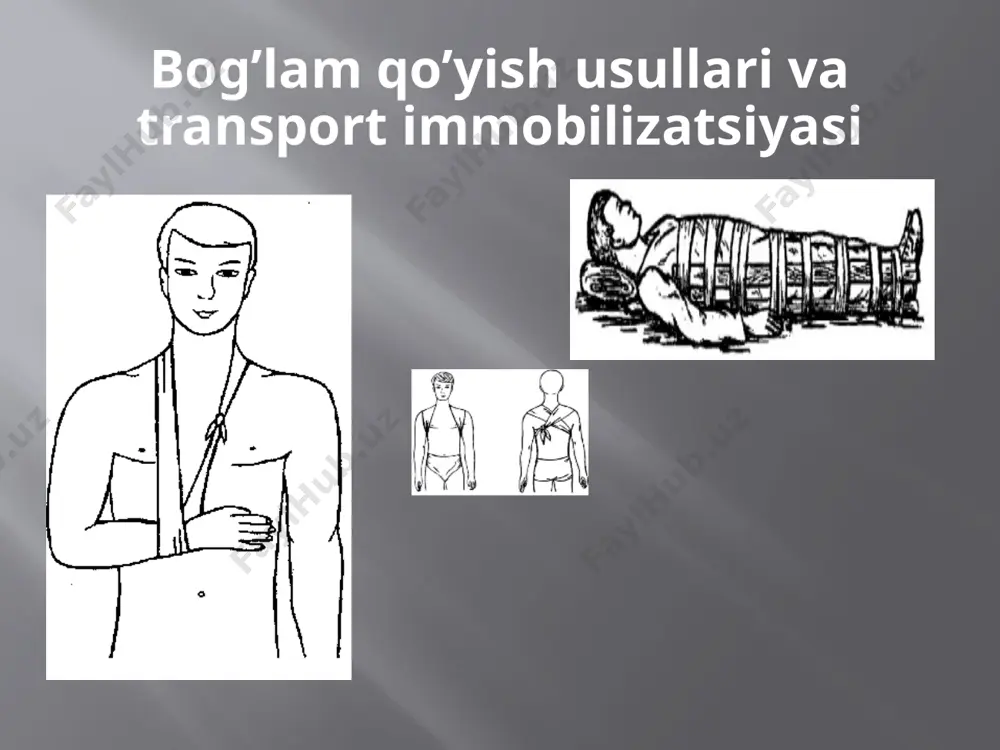 desmurgiya va transport immobilizatsiyasi - Page 5