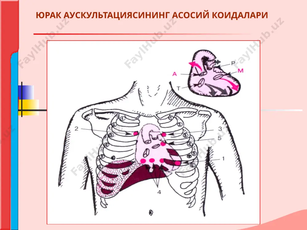 нини сусайиши: юрак тонларини сусайиши хамда аниклигини пасайиши – бугиклашган тон дейилади, тонларнинг кескин сустлашиши эса - бугик тон дейилади. юракдан ташкари булган омиллар: жуда калин ёки шишган кукрак девори, катта сут безлари. плеврал бушликка ёки перикардга суюклик тулиши. упка эмфиземаси. юрак тонлари юрак омиллари: юрак мушакларининг уткир ва сурункали касалликларида,(кискариш фаолиятининг пайиши): миокардитларда, миокард дистрофияларида, кардиосклерозда, коллапс, перикард бушлигида суюклик булганда. масалан миокард инфарктида, юрак нуксонларида юракнинг декомпенсацияси, периферик кон айланишининг уткир етишмовчилиги. диагностик нуктаи назардан тонлардан бирини узгариши ахамтлирокдир, чунки бундай узгаришлар айнан юрак хасталикларида кузатилади. юрак тонлари 3. юрак чуккисида ва туш суягининг ханжарсимон усиги асосида 1-тоннинг кучайиши диастола даврида унг ёки чап коринчанинг кон билан таъминланишининг камайиши: бу чап атриовентрикуляр тешикнинг торайиши (митрал стеноз) , унг атриовентрикуляр тешикнинг торайишида кузатилади . экстросистола юрак тонлари 4. юрак чуккисида ва туш суягининг ханжарсимон усиги асосида 1-тоннинг сусайиши митрал ёки уч тавакали клапан етишмовчилигида.. атроивентрикуляр клапан ва упка артерияси …