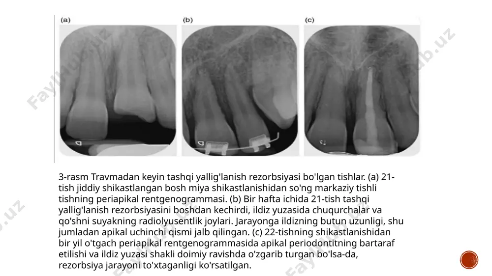zamonaviy rentgen tashxislash usullari - Page 5