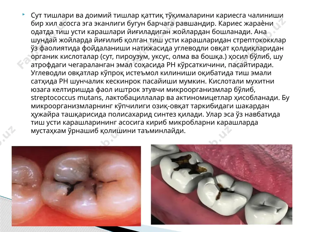 mikrobiologiya va kariyes - Page 4