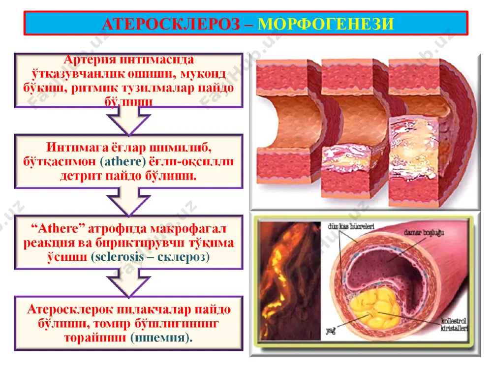 атеросклероз. гипертония касаллиги - Page 4