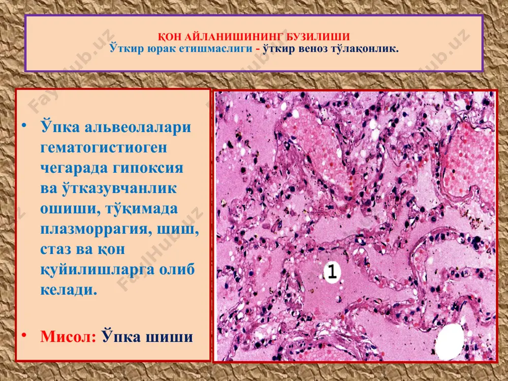 қон айланишининг бузилиши - Page 5