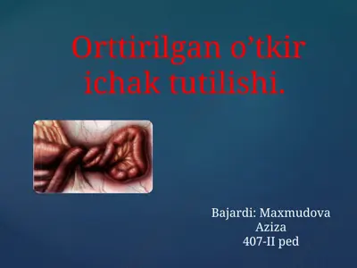 ichak tutilishi — PPTX