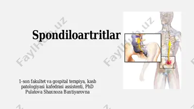 spondiloartritlar — PDF