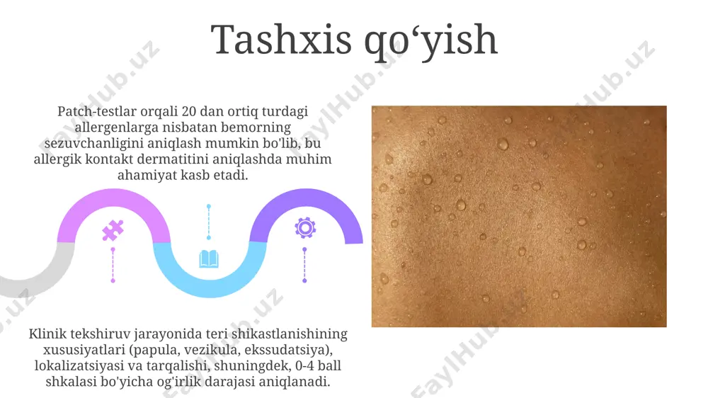 oddiy va allergic kontakt dermatit. toksik-allergik dermatit. ekzema - Page 5