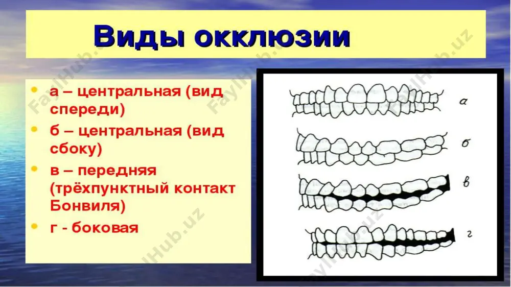 oklyuziya va artikulyatsiya tushunchasi - Page 4