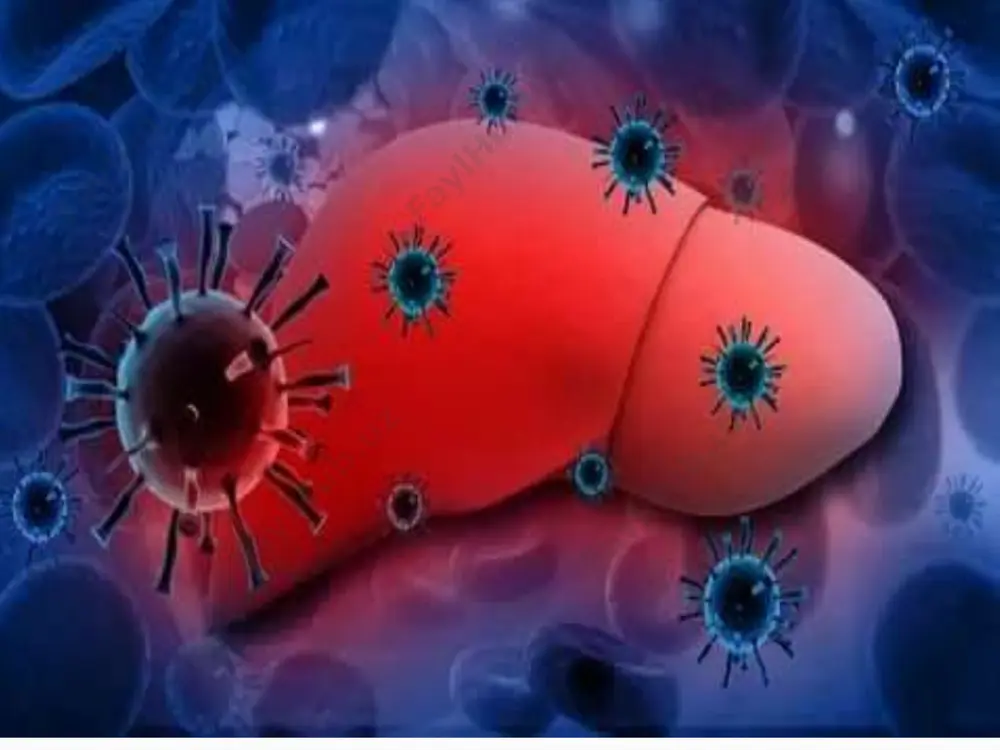 ng uchun tozalangan suvda ham saqlanib qoladi. suvning fekal ifloslanishidan epidemiya yuzaga kelishi mumkin. kasallikning ko‘payishi sovuq mavsumga to‘g‘ri keladi (kuzning oxiri yoki qishda). kasallik bilan og‘riganlarda kasallik qaytalanmay antigen tuzilishi qo‘zg‘atuvchi yagona antigendan tashkil topgan va asosiy ag, (na-ag) tutadi va shu ag ga ko‘ra identifikasiya qilinadi. kasallik patogenezi odam organizmiga suv yoki ovqat orqali tushgan gepatit a virusi ingichka ichakning shilliq qavati epiteliysida va regionar limfoid to'qimada ko‘payadi. keyin qisqa vaqtli virusemiya rivojlanadi. virusning qondagi maksimal konsentrasiyasi kasallikning yashirin davri oxirida va sariqlik oldi davrida kuzatiladi shu vaqtda qo(zg‘atuvchi fekaliy orqali ajralib turadi. sitopatogen ta’sir nishoni - gepatositlar. virusning reproduksiyasi gepatositlar sitoplazmasida kechadi va ulami o‘limga olib keladi. sitopatik ta’sir immun mexanizmni kuchaytiradi, ya’ni virus ifn hosil bo‘lishini indusirlaydi, ifn esa, nk-hujayralami faollaydi. mikrobiologik diagnostikasi virusning replikasiyasi markyorlari — gepatit a virusi antigeniga qarshi hosil bohgan at (igm va igg) va virus rnk sl ko‘rsatilgan markyorlar if a …