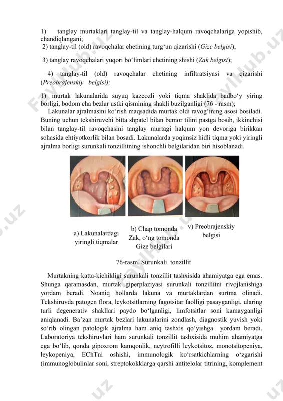 qator a’zolar faoliyatining buzilishiga yoki organizm himoya kuchini pasayishiga, xususan uni autosensibilizatsiyasiga olib keladi. murtak asab tolalarining buzilishi limfadenoid to‘qima trofikasiga ta’sir ko‘rsatib, natijada funksional va morfologik o‘zgarishlar yanada chuqurlashib, jarayon toksik-allergik bosqichiga o‘tadi. murtak asab elementlaridagi ayrim o‘zgarishlar (asab tolasi varikozi, retseptorlar uchi sharsimonligi) organizmning kompensator - moslashuv reaksiyasi bo‘lib, destruktiv o‘zgarishlarni bartaraf etilishiga yordam beradi. tashxis anamnez malumotlari, bemor shikoyatlari, limfa tugunlari kattalashishi, og‘rishi, faringoskapiya, labaratoriya, allergologik, immunologik, bakteriologik va boshqa tekshiruvlar asosida qo‘yiladi. surunkali tonzillit tashxisini kasallik xuruji paytida (anginada) qo‘yish tavsiya etilmaydi, chunki bemor shikoyatlari va faringoskopiya manzarasi jarayonning surunkali kechimini emas, balki uning o‘tkir bosqichini aks ettiradi. anamnez ma’lumotlarida tez-tez takrorlanib turgan anginalar haqida ma’lumotni mavjudligi surunkali tonzillit tashxisinini ishonchli belgisi hisoblanadi. odatda surunkali tonzillit bir yilda 2-3 marta, ba’zan 5-6 marta avj olib turadi, ammo bir yilda 1 marta kuzatilgan anginani ham b.s.preobrajenskiy fikricha tez-tez takrorlanuvchi angina sifatida baholash lozim. 4% hollarda surunkali tonzillitning …