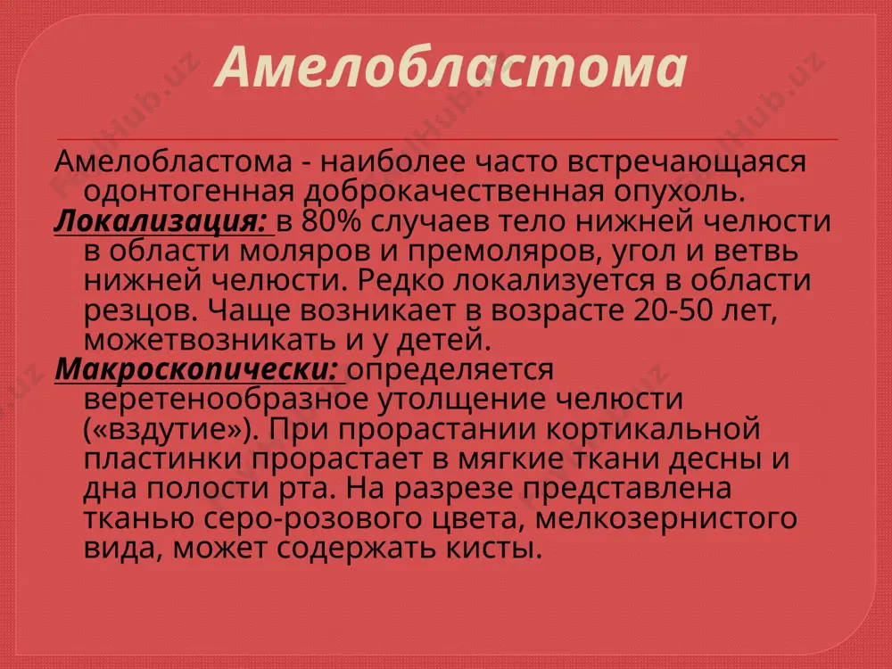 разрушается. микроскопически остеомы делят на губчатые и компактные остеома верхней челюсти .опухоль располагается в верхнечелюстной пазухе и полости носа (рентгенограмма) остеома нижней челюсти (рентгенограмма). опухоль располагается в области угла. .остеома нижней челюсти. а— компактная; б — губчатая. остеогенная саркома остеогенная саркома - самая частая недифференцированная опухоль челюстных костей. чаше возникает у лиц мужского пола в возрасте 10-20 лет. растет очень быстро. рано дает гематогенные ме- тастазы. локализация: верхняя челюсть. макроскопически: не имеет четких фаниц, разрушает кортикаль- ную пластинку челюсти, прорастая в мягкие ткани. зубы в пределах опухоли выдвигаются, становятся подвижными. может возникнуть патологический перелом челюсти. микроскопически: выделяют остеолитическую и остсобластиче- скую формы. в остеобластической остсогенной саркоме определя- ются атипичные, полиморфные остеобласты, атипичный остеоид и атипичные костные балочки. в остеолитической остсогенной сарко- ме наблюдаются очаги некроза, кровоизлияний, кисты. рис. 175. остеогенная саркома нижней челюсти. а- внешний вид больного; 6 — внутриротовая рентгенограмма хондрома хондрома - доброкачественная опухоль из хрящевой ткани. локализация: …