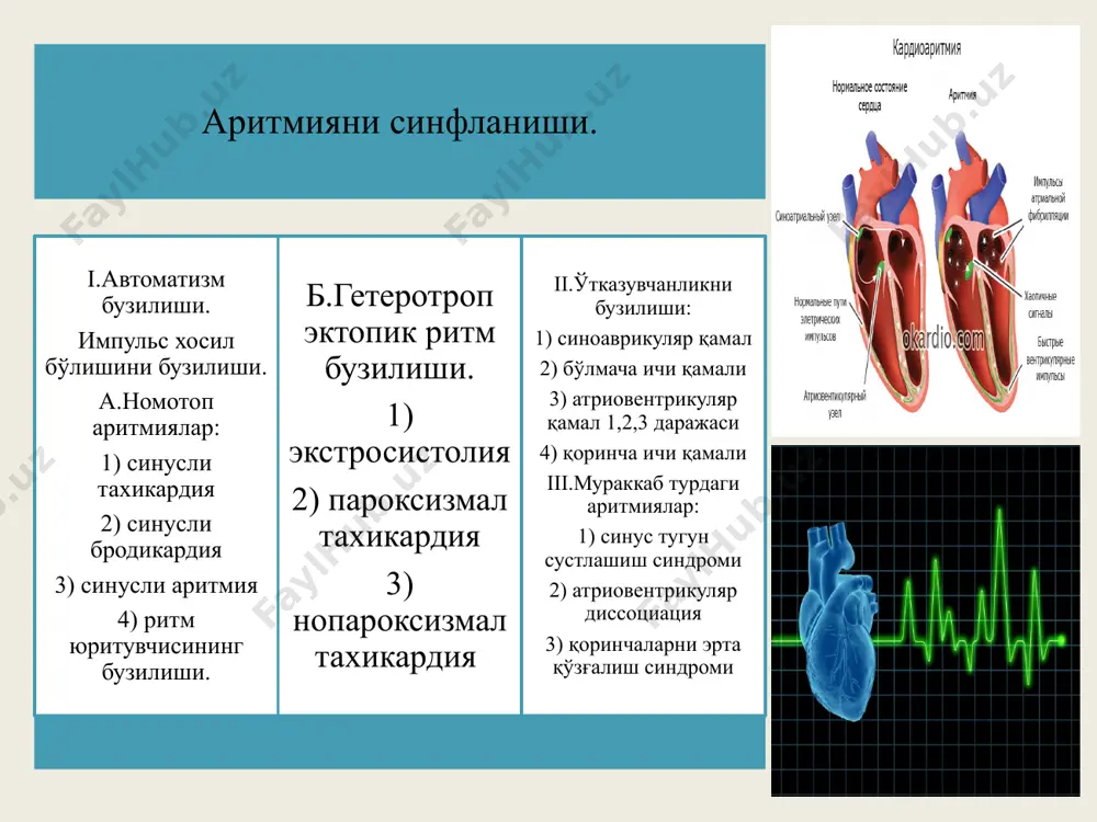 қ бўлмачаларга, аниқроғи ўнг бўлмачанинг юқори қисмида,яъни синус тугунига яқин жойлашган бўлса экгда р тишча нормал худди синус тугундан чиққан р тишчага ўхшаб кетади. qrs нормал r-r қисқарган ва бир хил бўлади. бу холат кўпинча птни синусли тахикардиядан фарқлашга қийин бўлади. юрак уриш сони (юқс) минутига 140-160 та бўлса ,экгда пт ва ст ни бир-биридан фарқлаб бўлмайди. бунда бизга клиника ёрдам беради. птда юқс тўсатдан бирданига тезлашади ва тўсатдан нормал холатга келади. ст да эса аста-секин тезлашиб,аста-секин секинлашади яна бир томони агар юқс 1 минутда 140 дан кам бўлса синусли тахикардия дейилади. юқс 1 минутда 160 тадан кўп бўлса кўпинча пт бўлади. агар эктопик ўчоқ бўлмачаларни ўрта қисмида жойлашган бўлса, экгда р тишча ўзгарган икки фазали бўлиши мумкин. qrs нормал, r-r оралиқлар қисқарган ва бир хил бўлади. агар эктопик ўчоқ бўлмачаларни пастки қисмида жойлашган бўлса экгда qrs дан олдин р тишча манфий бўлади. qrs нормал r-r оралиғи қисқарган ва бир …