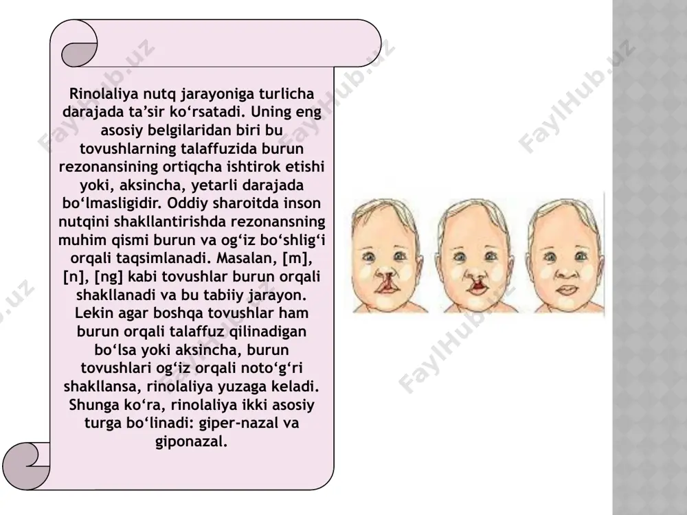 rinolaliyani buzilish mexanizmi, sabablari va uni aniqlash - Page 5