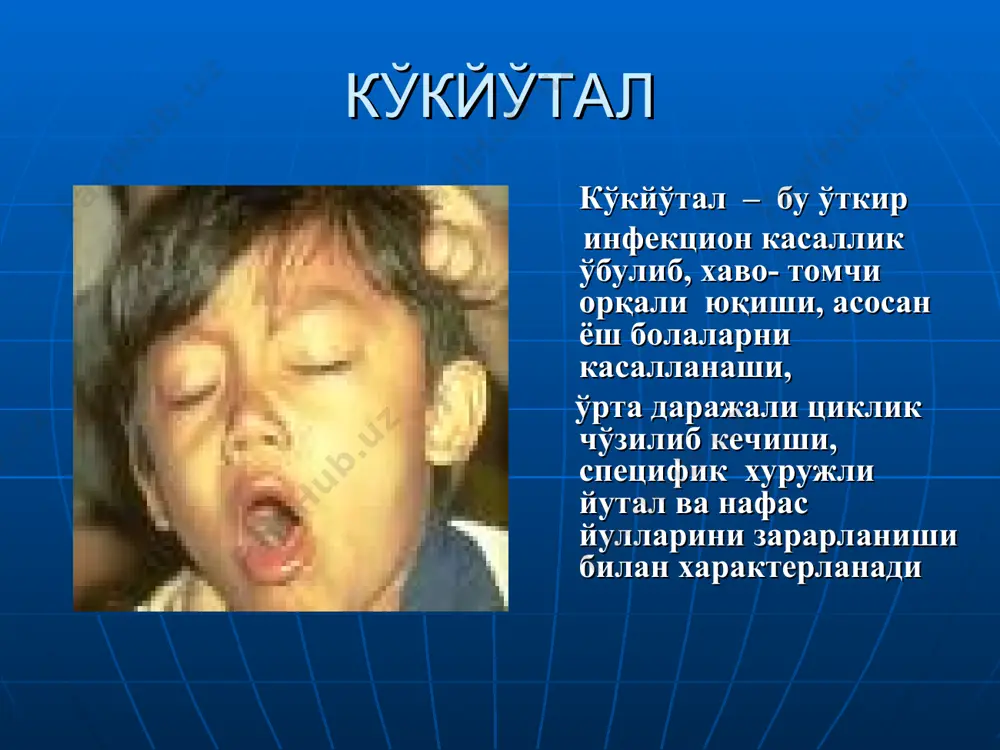 р колонизацияси. микробларнинг купайиши, химоялашнинг носпецифик факторлар таъсирида уларнинг халок булиши ва эндотоксин ажралиши, ажралган токсин махаллий яллигланишга олиб келиши. нафас йулларини рецепторларининг китигланиши окибатида, афферент импульслар пайдо булиши ва уларнинг йутал марказига етиб бориши кукйутал патогенези (2) марказий нерв тизимида димланиш учогини пайдо булиши ва унда ухтомский доминантасига хос белгилар борлиги. бронхлардаги яллигланиш, ажралмалар куплиги, гипоксия, эмфизема, специфик кукйутал аллергияси иккиламчи бактериал инфекцияни ривожланишига олиб келиши. кукйутал таёкчаси ва унинг токсини упканинг лимфоид тукималрнга хаддан ташкари таъсир курсатиш окибатида, кондаги лейкоцитозни лимфоцитозга утиши кукйутал патогенези (3) упкада кон айланиш ва вентиляция бузилиши гипоксия холатига олиб келиши тукималарда кислород етишмовчилиги оксидланиш жараени бузилишига ва ацидоз холатига олиб келиши гипоксия ва ацидоз кукйутал токсини нейротроп таъсири билан кушилиб мнс фаолиятини бузилишига олиб келиши нафас олиш ритмини бузилиши, инспиратор апноэ кукрак кафасини босимини кутарилишига ва уткир альвеоляр эмфиземаси альвеоллар ерилишига олиб келиши . жарохатланувчи органлар ва асосий синдромлар кукйуталда упкани узгариши бронхитлар …