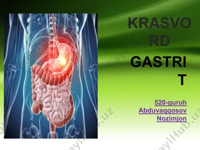 gastrit — PPTX