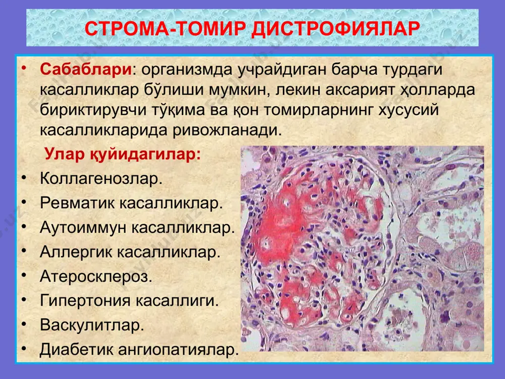 ие соединительной ткани (атеросклеротическая, или фиброзная бляшка)