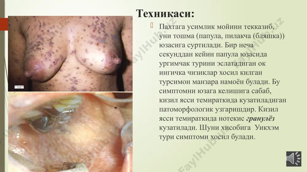 uwikhem turi simptomi - Page 3