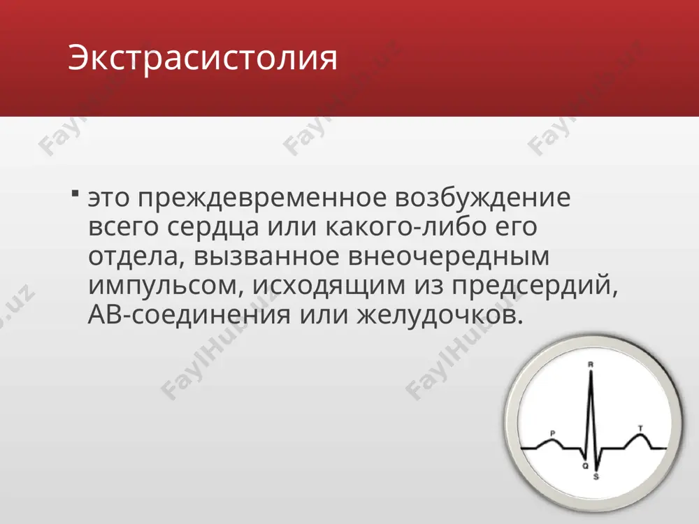 постэкстрасистолическому желудочковому комплексу, возникающему после продолжительной компенсаторной паузы, обычно имеют большую амплитуду. диагностика аускультация сердца. во время экстрасистолического сокращения выслушиваются несколько ослабленные преждевременные i и ii (или только один) экстрасистолические тоны, а после них — громкие i и ii тоны сердца, соответствующие первому постэкстрасистолическому желудочковому комплексу. диагностика инструментальные исследования для постановки диагноза экстрасистолии достаточно стандартной экг в сочетании с холтеровским мониторированием. нередко на экг или при холтеровским мониторировании экстрасистолии выявляютя случайно (при отсутствии жалоб). интервал сцепления - это расстояние от предшествующего экстрасистолы очередного цикла p–qrst основного ритма до экстросистолы. диагностика компенсаторная пауза - расстояние от экстрасистолы до следующего за ней цикла p–qrst основного ритма. различают неполную и полную компенсаторную паузу: неполная компенсаторная пауза. неполная компенсаторная пауза - это пауза, возникающая после предсердной экстрасистолы или экстрасистолы из ав-соединения, длительность которой чуть больше обычного интервала p–p (r–r) основного ритма. полная компенсаторная пауза. полная компенсаторная пауза - это пауза, возникающая после желудочковой экстрасистолы, …
