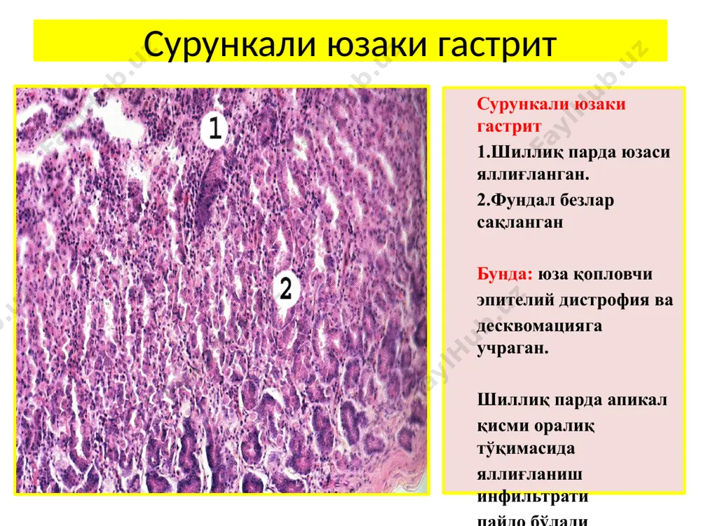 меъда касалликлари - Page 5