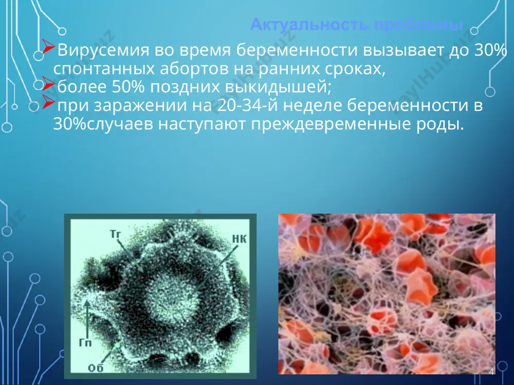 а цереброспинальная жидкость. самое главное - идентификация микроба в разных материалах. токсоплазмоз это очень широко распространенное заболевание, которым заражено почти 30% людей в мире. первичный хозяин - домашняя кошка. заражение токсоплазмой может произойти через грязные руки, через сырое или недоваренное (недожаренное) мясо. частота 1:1000 новорождённых. у беременных клиника заболевания протекает по типу мононуклеоза или гриппа, с высокой температурой или очень длительным субфебрилитетом, увеличены лимфоузлы. клиника классическая триада: гидроцефалия хориоретинит внутричерепные кальцификаты. у некоторых новорожденных может возникать клиника сепсиса и выявляться желтуха, гепатоспленомегалия, пурпура и глухота. б.. intracranial calcifications chorioretinitis диагностика выявление специфических igm методом ифа. если при первичном исследовании обнаружены антитела класса igm, то сразу показана этиотропная терапия. если обнаружены только igg, то исследование повторяют через 4 недели. терапия показана при нарастании титра антител. лечение лечение новорождённых предполагает следующую схему: хлоридин + сульфадимезин + фолиевая кислота. курс 4-6 недель. в течение первого года 4 курса с перерывом 1,5 месяца одновременно …